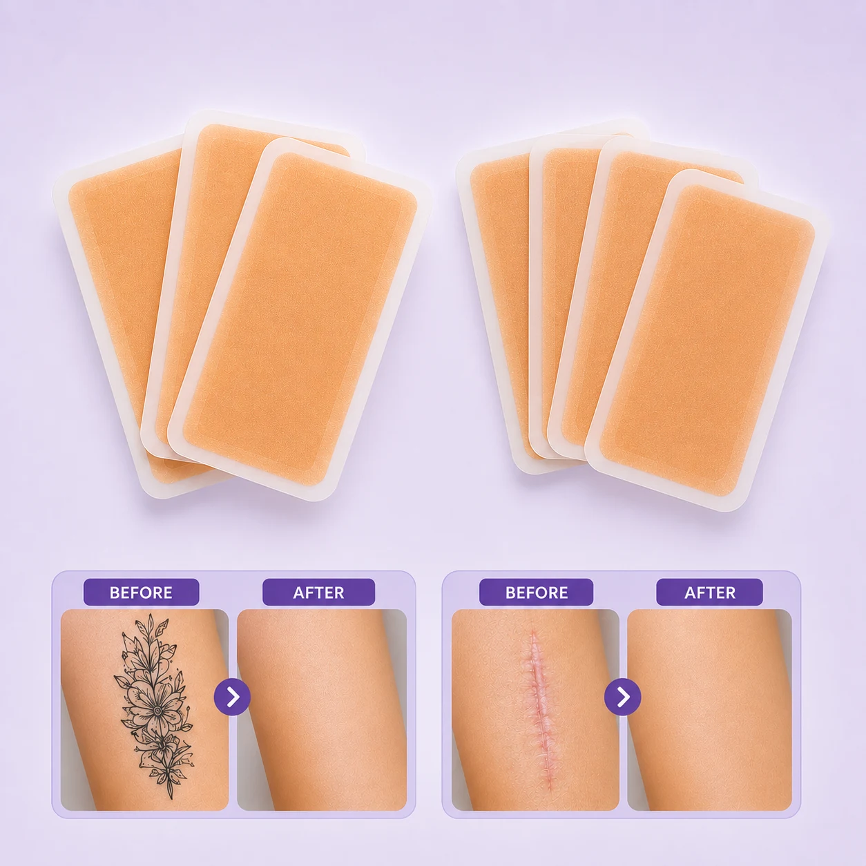 Tattoo/Scar Cover Sticker (Natural Tone)